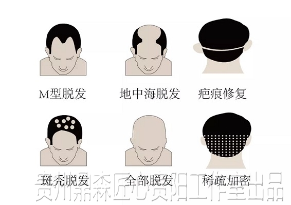 贵州纹发培训在哪里？学习贵州纹发技术哪家好？