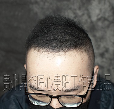 贵州纹发机构有自己的“独门秘籍”