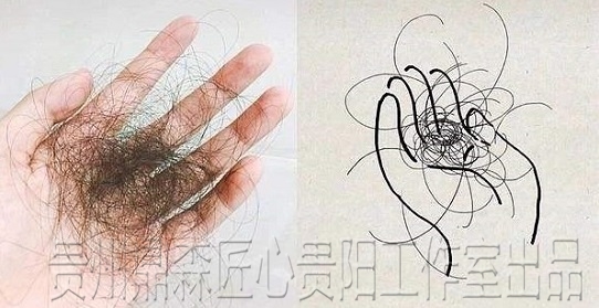 贵州人，你脱发、秃顶吗？请了解视觉止脱技术：纹发