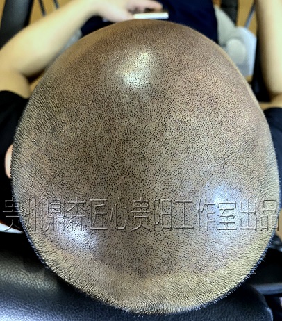 在国外的纹发技术会更好吗？