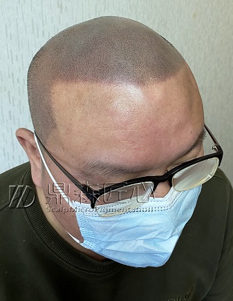 贵阳纹发已经成为发友首选的颜值保护伞