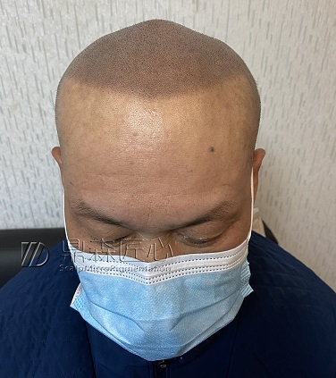 摆脱油腻男其实也很简单—SMP纹发