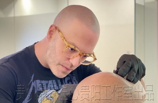 贵阳纹发对头皮的创伤程度，以及它的恢复过程是怎样的？