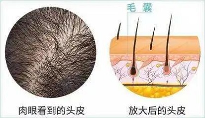 某些精油对头发生长有些许帮助，不过纹发更可靠