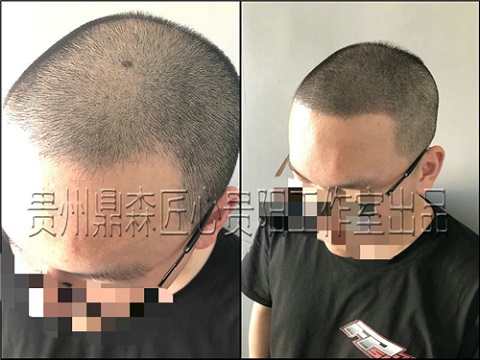 贵阳纹发工作室快五岁了，鼎森匠心纹发技术获得质的突破