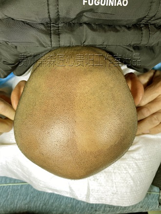 如何识别SMP纹发后照片真实性？