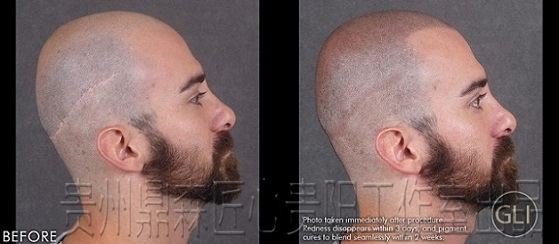 如果你不了解贵州庆纹发，你将错过一种改善脱发的创新解决方案