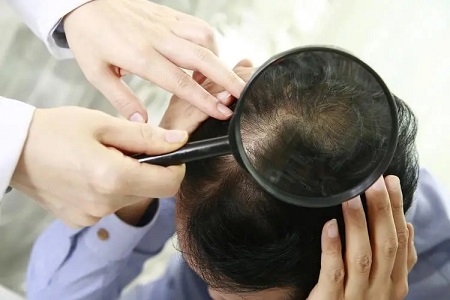 脱发还是多发都只是一种头发造型，保持自信和积极的态度最重要