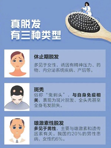 发现有脱发的征兆后，怎么办？