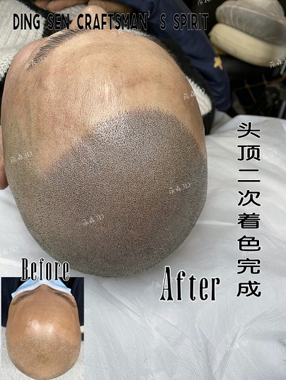 选择贵阳纹发刻不容缓,整个夏天都很凉爽 选择贵阳纹发刻不容缓,整个夏天都很凉爽