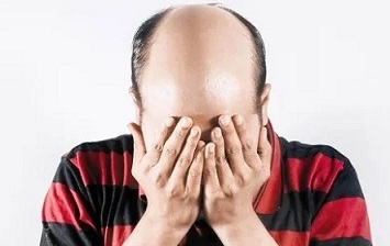 脱发并不是绝望的情况,仍然有希望和解决方案 脱发并不是绝望的情况,仍然有希望和解决方案
