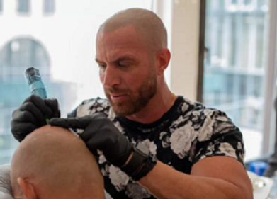 适合贵州纹发的几类的脱发群体