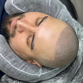 贵阳纹发的效果持久的核心是什么？