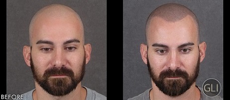 贵州纹发师的审美水平决定效果的自然度和美观度