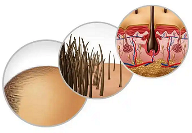 头发构造的相关知识? 头发构造的相关知识?