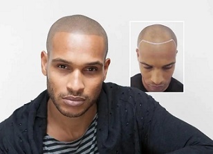 贵州纹发前后的心理转变