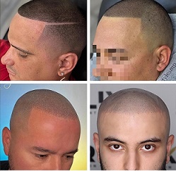 贵阳纹发不仅是视觉上的 “年轻”，更是心理与生活状态的重启