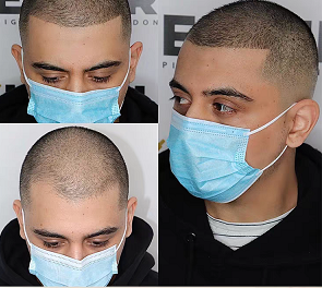 掌握纹发知识,能帮你有效避坑,安心收获理想效果 掌握纹发知识,能帮你有效避坑,安心收获理想效果