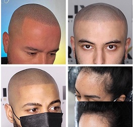 纹发审美的核心价值与重要性是什么？