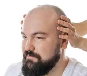 为什么后枕部头发不容易脱发？